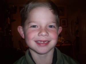 Ben Lost A Tooth